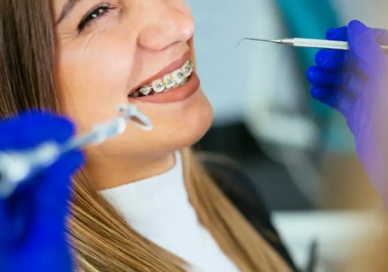 SameDay Braces After Tooth Extraction Is it Possible?