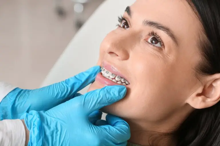 Can You Put Braces on Any Teeth? A Guide to Orthodontic Treatment