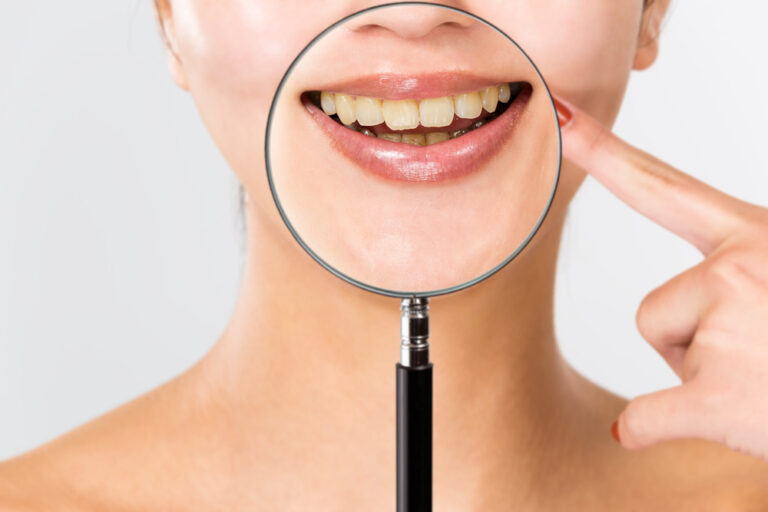 Can You Put Marker On Your Teeth? (Risks & Safer Alternatives)