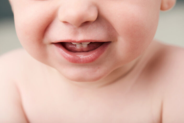 Can You See Baby’s Teeth Through the Front of Gums? A Guide for New Parents