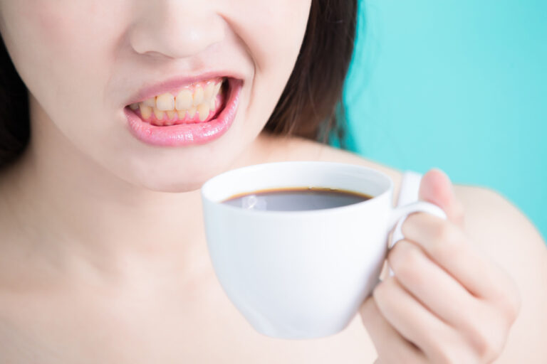 Can You Stain Your Teeth Yellow? (Causes, Preventions & Removal Methods)