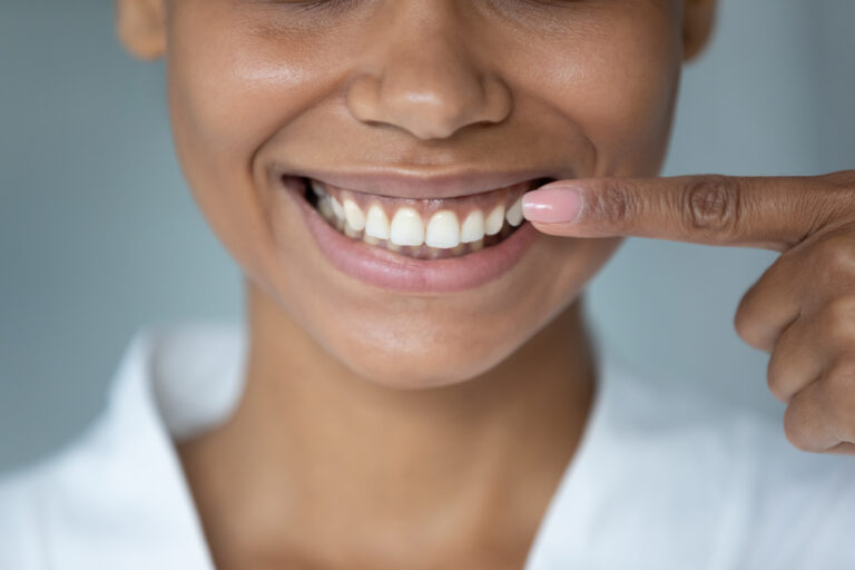Can Your Teeth Affect Other Parts of Your Body? Exploring the Link Between Oral Health and Overall Wellness