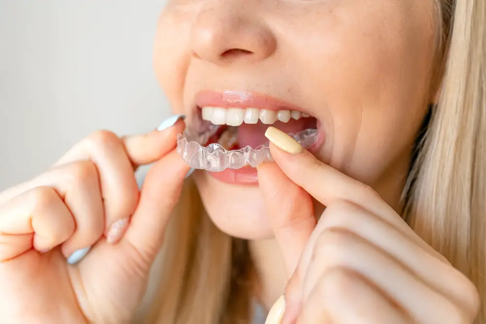 Can Your Teeth Shift Even If You Wear Your Retainer? Exploring the