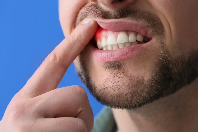 Can a Tooth Abscess Shrink on Its Own? Exploring the Possibility of Natural Healing