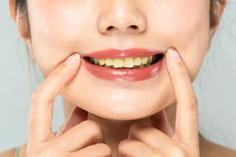 Can Badly Yellow Teeth Be Whitened? (Causes & Treatments)