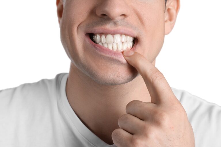 Can gums pull away from teeth? (symptoms, stages and treatments)