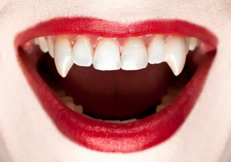 Can people have vampire teeth naturally? (You’d Love To Know)