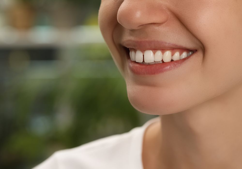 Can plaque cause gaps between teeth