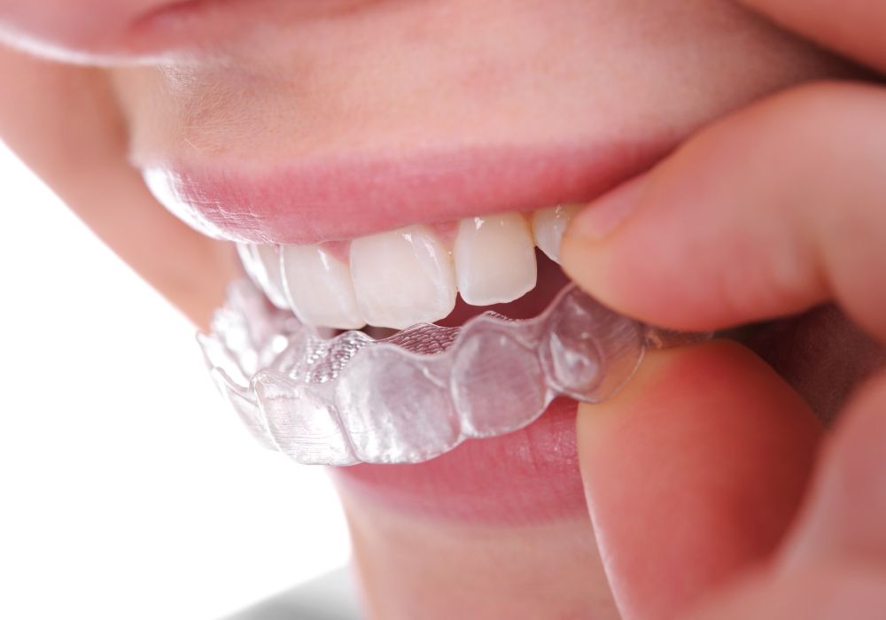 Can shifting be prevented after orthodontic treatment