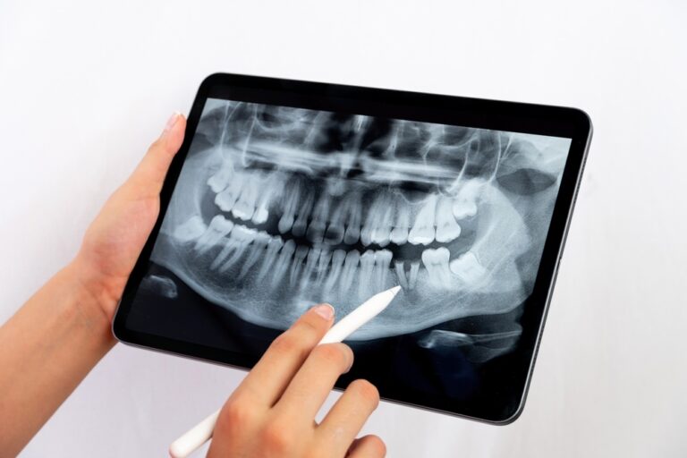 Can steel damage teeth? (Signs, Treatment & Prevention)