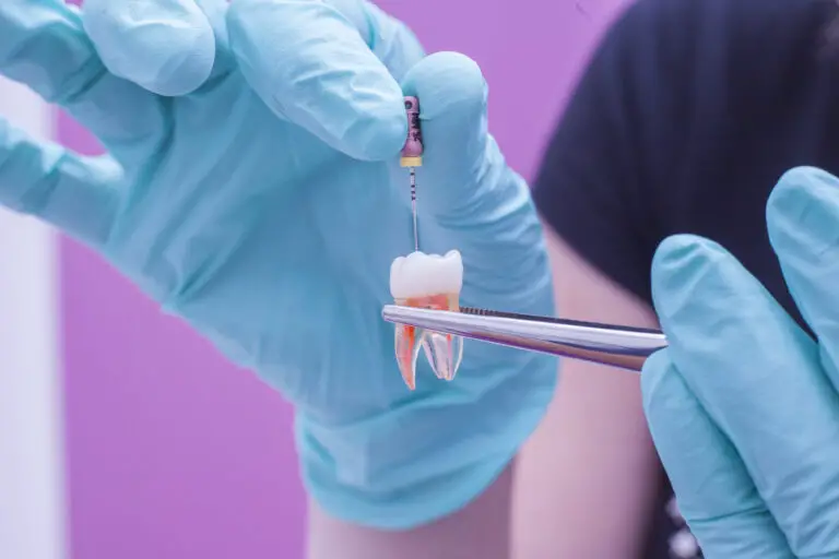 Can Teeth Survive Without Nerves? (Everything You Need To Know)