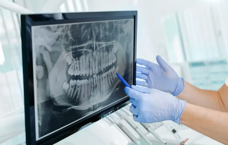 Can Tooth Resorption Heal On Its Own? (Ultimate Guide)