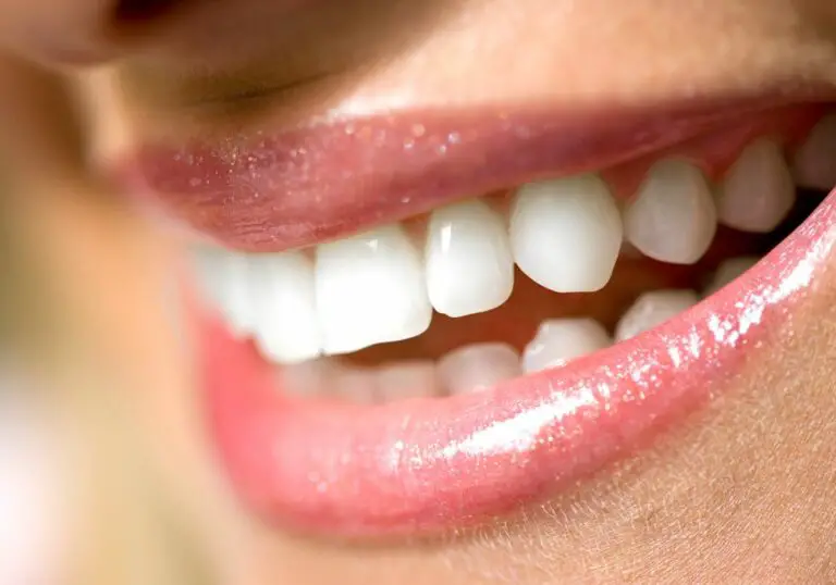 Can translucent teeth go back to normal? (Everything You Need To Know)