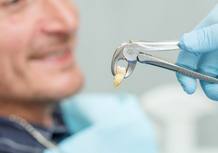Can Wisdom Teeth Be Removed by a Dentist? Exploring Your Options