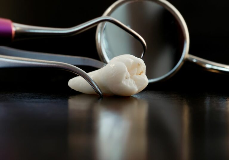 Can wisdom teeth change teeth alignment? (You’d Love To Know)
