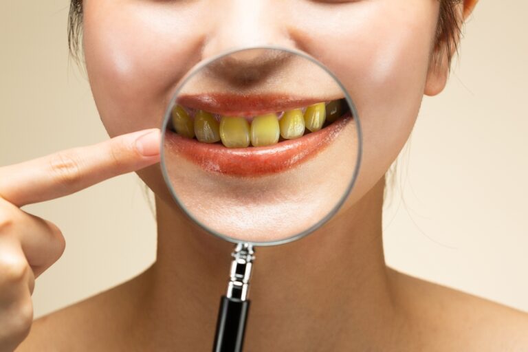 Can Yellow Teeth Become White Again? (Natural Home Remedies)