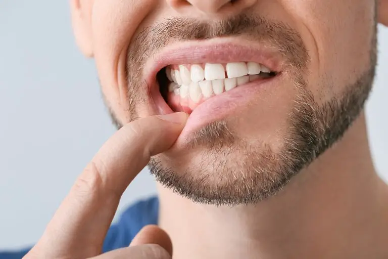 Can you fix receding gums? (nonsurgical and surgical treatment options)