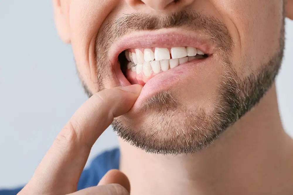Can you fix receding gums? (nonsurgical and surgical treatment options)