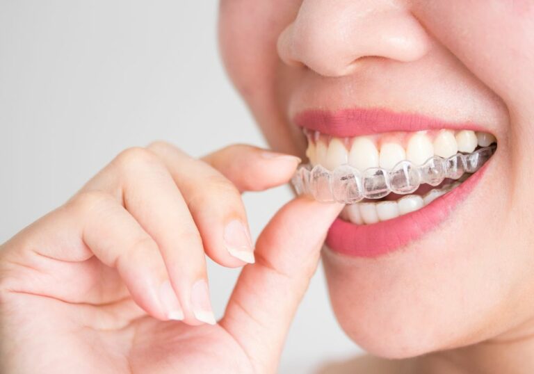 Can you get Invisalign with fake teeth? (You’d Love To Know)