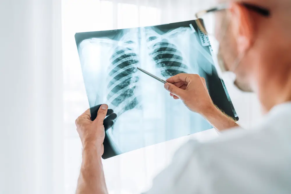 Chest Pain After Tooth Extraction