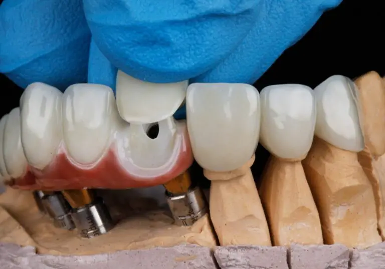 Can You Make Your Teeth Longer with Veneers? Exploring the Possibility