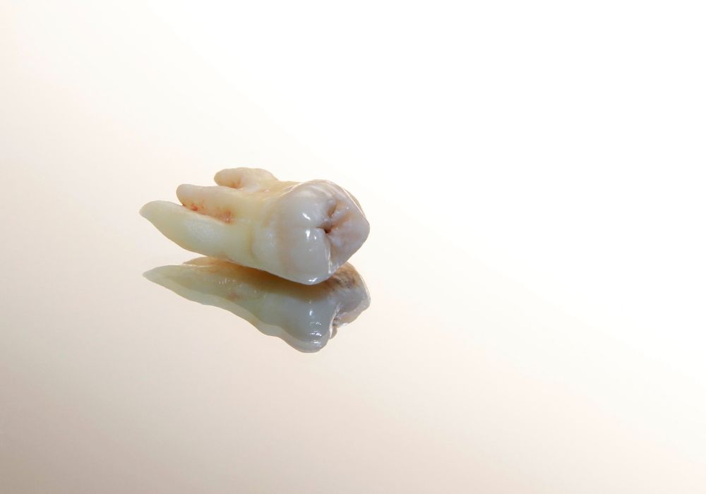Can You Pull A wisdom Tooth Without Surgery? (Less Invasive Extraction)