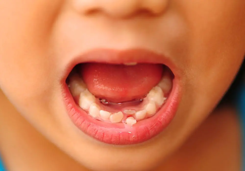 can-you-save-loose-teeth-from-falling-out-stabilization-tips