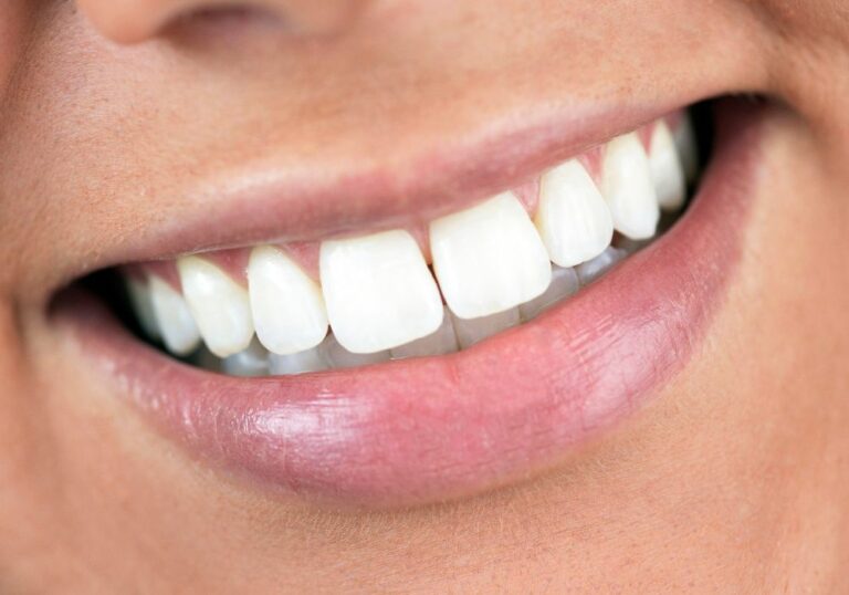 Can You Temporarily Paint Your Teeth White? (Effectiveness & Safety Precautions)