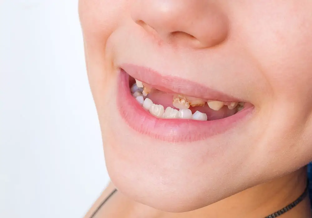 Causes of stunted front tooth growth