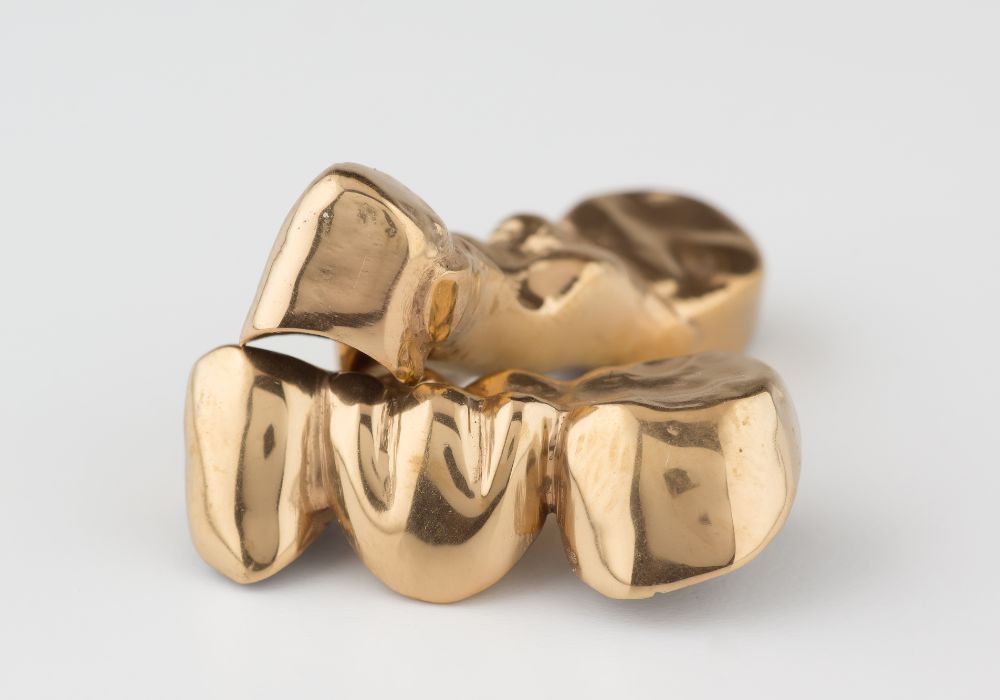 Concerns about the Gold Teeth