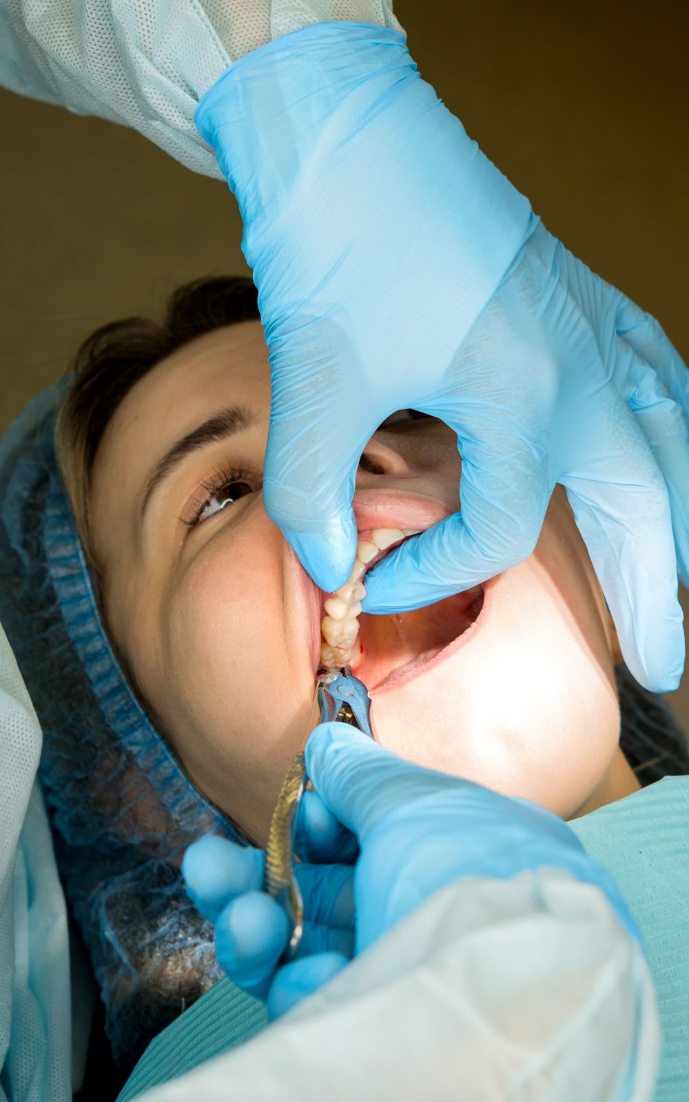 Considerations Before Wisdom Teeth Removal
