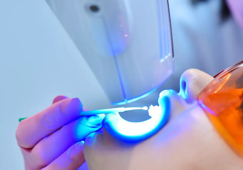 Considerations of Blue Light Whitening