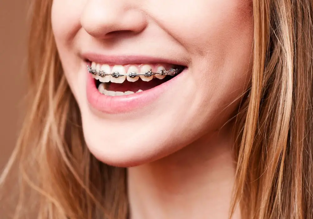 Commonly Asked Questions About Tooth Jewelry - Aces Braces