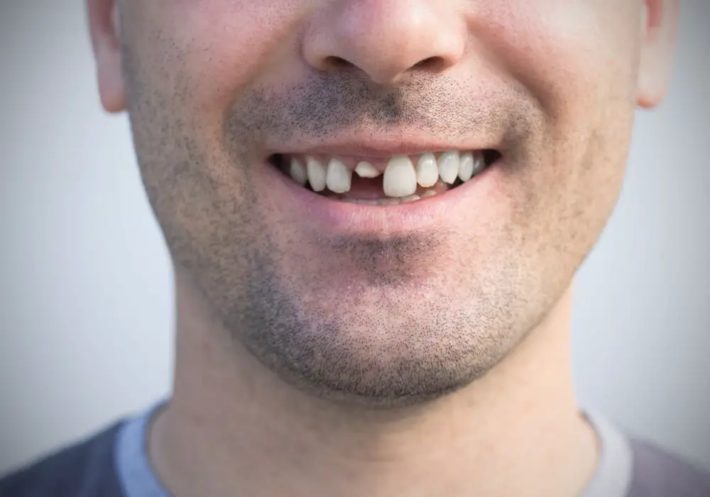 Dental procedures to repair damaged teeth