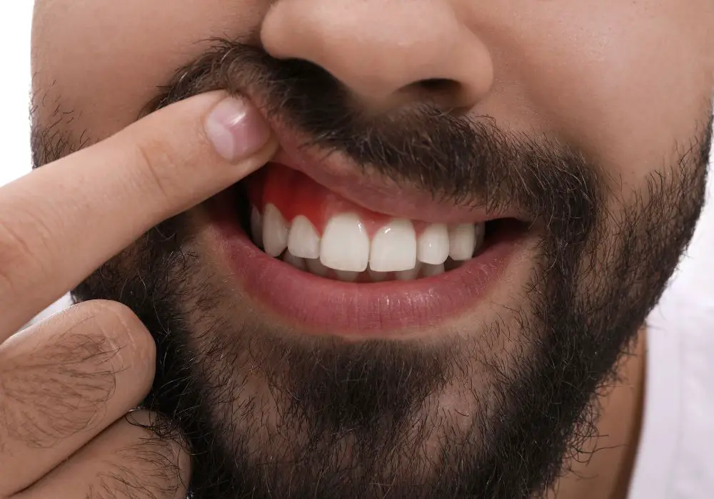 Diagnosing Gum Recession and Loose Teeth