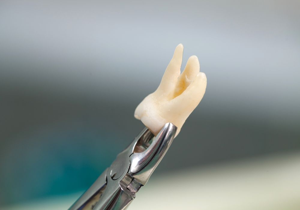 Does bone loss always lead to tooth loss?