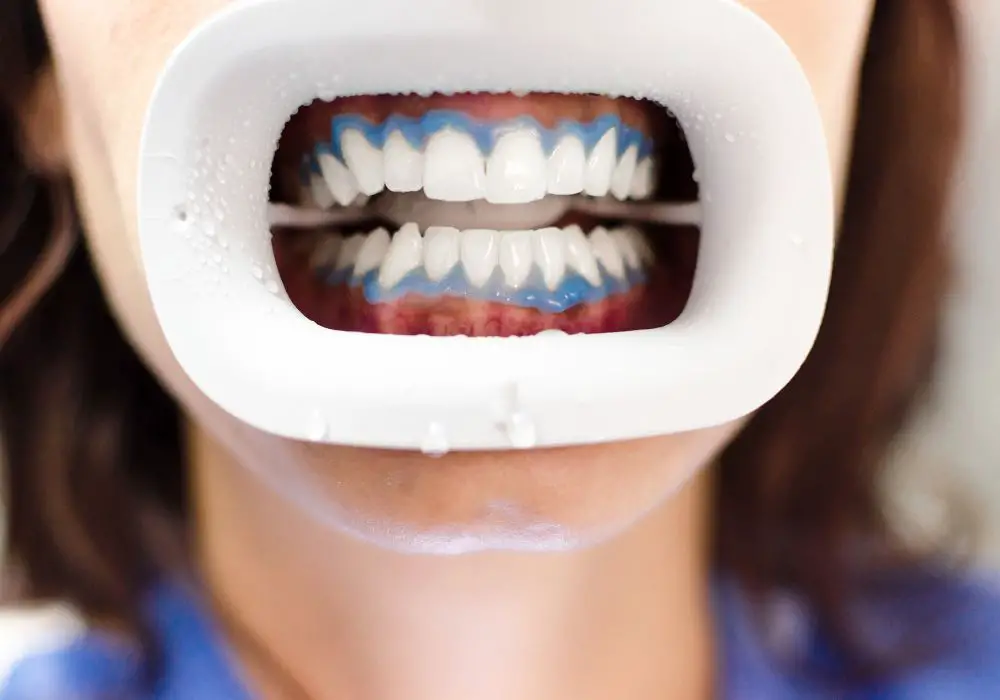 Effective Methods of Whitening Teeth with Hydrogen Peroxide