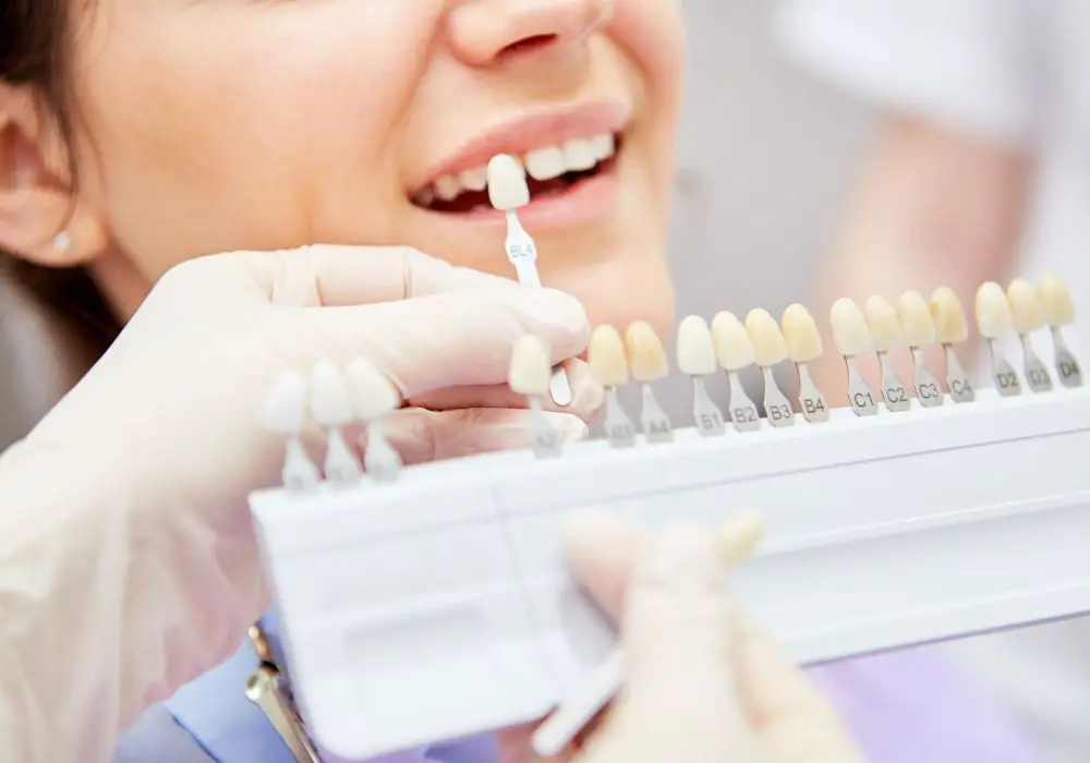 Evaluating your tooth discoloration