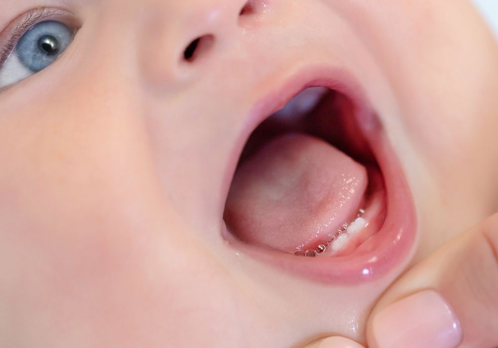Frequently Asked Questions about Natal Teeth