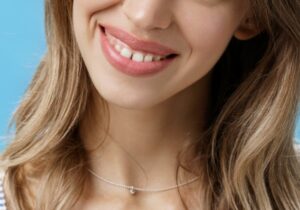 Why Does Madonna Have A Gap In Her Teeth? (Variety Theories)