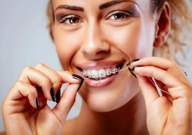 Why Do I Have Marks on Teeth After Getting My Braces Off? (Prevention Tips)