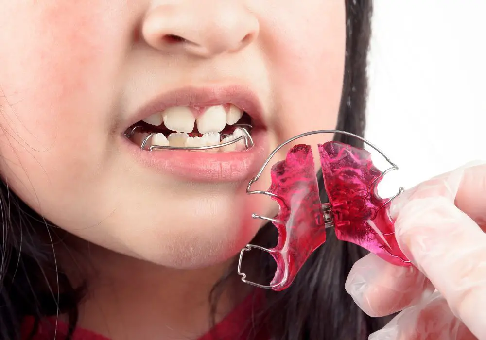How Much Tooth Movement is Possible with Retainers?