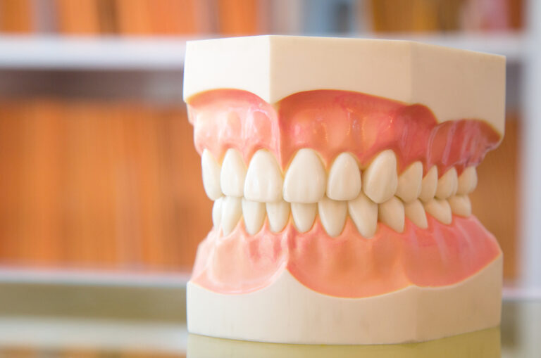 How Can I Darken My Gum Dentures? (Everything You Need To Know)