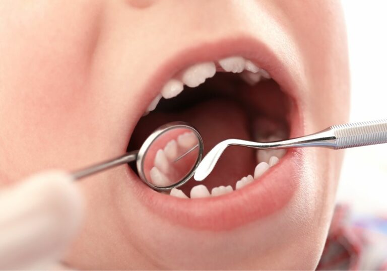 Helping Your 5-Year-Old with Teeth Grinding: Tips and Tricks