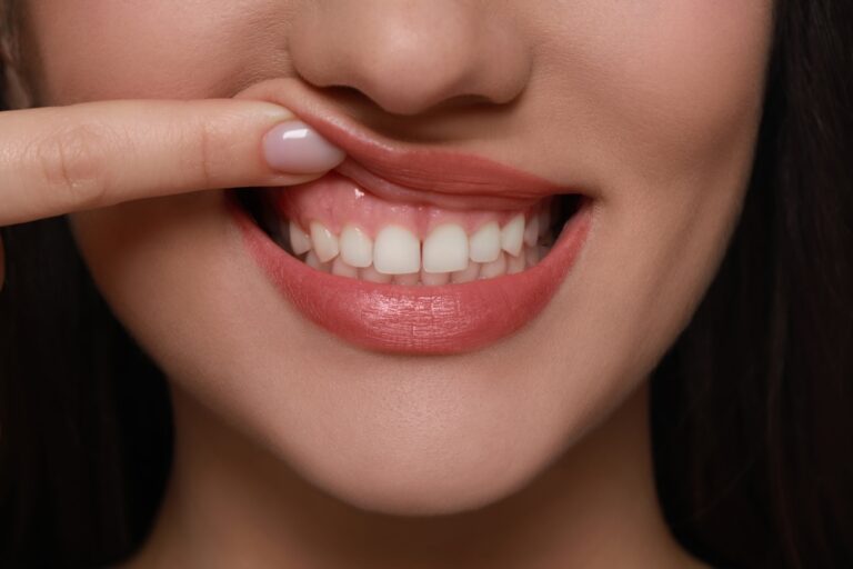 How Can I Increase Gum In My Mouth? (9 Natural Ways)