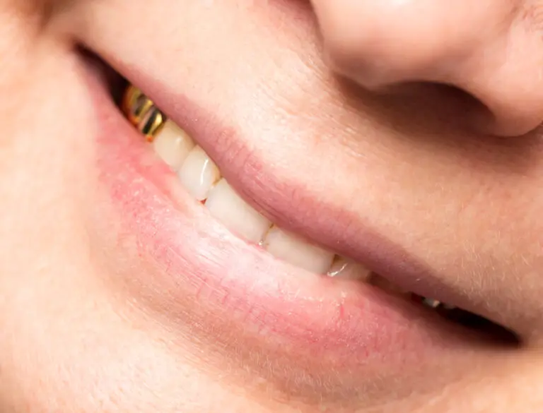 Shiny Smiles: How to Make Your Permanent Gold Teeth Sparkle