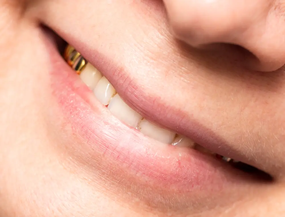 Shiny Smiles How to Make Your Permanent Gold Teeth Sparkle
