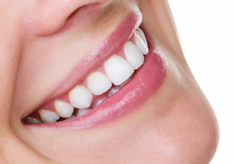How Can I Protect My Teeth Without A Crown? (Conservative Treatment Alternatives)