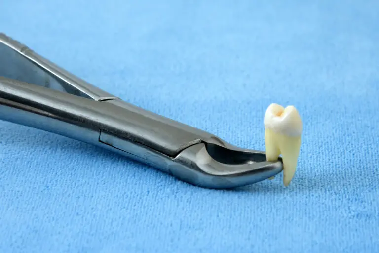 How Can I Pull My Tooth Out Early? (Ultimate Guide)