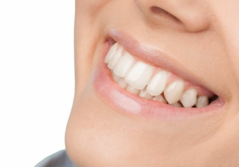 How Can I Push My Teeth Forward Naturally? (Natural Techniques and Options)